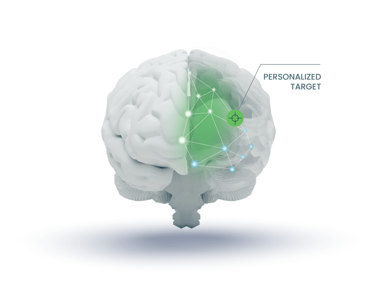 Magnus Medical brain image rendering highlighting
  SAINT