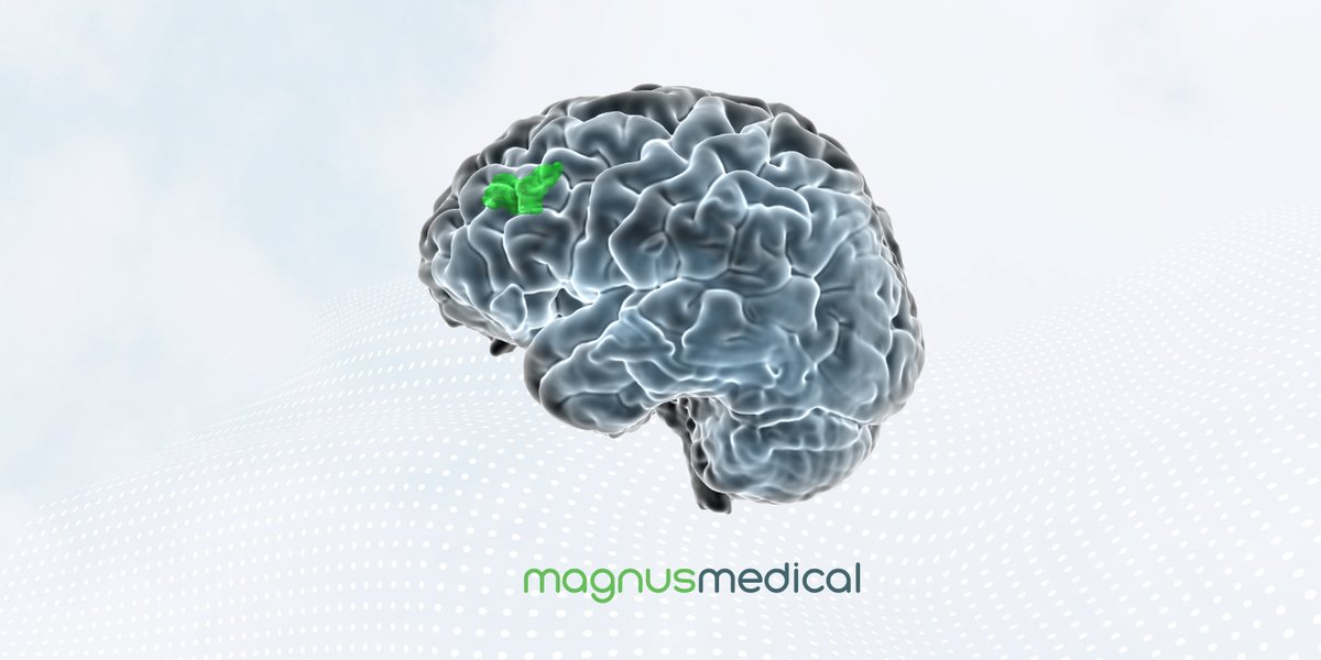 BURLINGAME, Calif., April 30, 2024 — Magnus Medical, Inc., a pioneering therapeutic neuromodulation company transforming the treatment of neuropsych